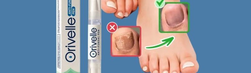 Main image of Orvelle Pen Uk